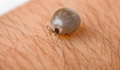 چطور از ابتلا به تب کریمه کنگو پیشگیری کنیم؟ 