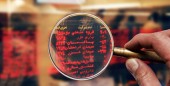 تامین مالی کوتاه‌ مدت و حمایت از سهام با انتشار اوراق اختیار فروش تبعی